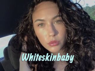 Whiteskinbaby